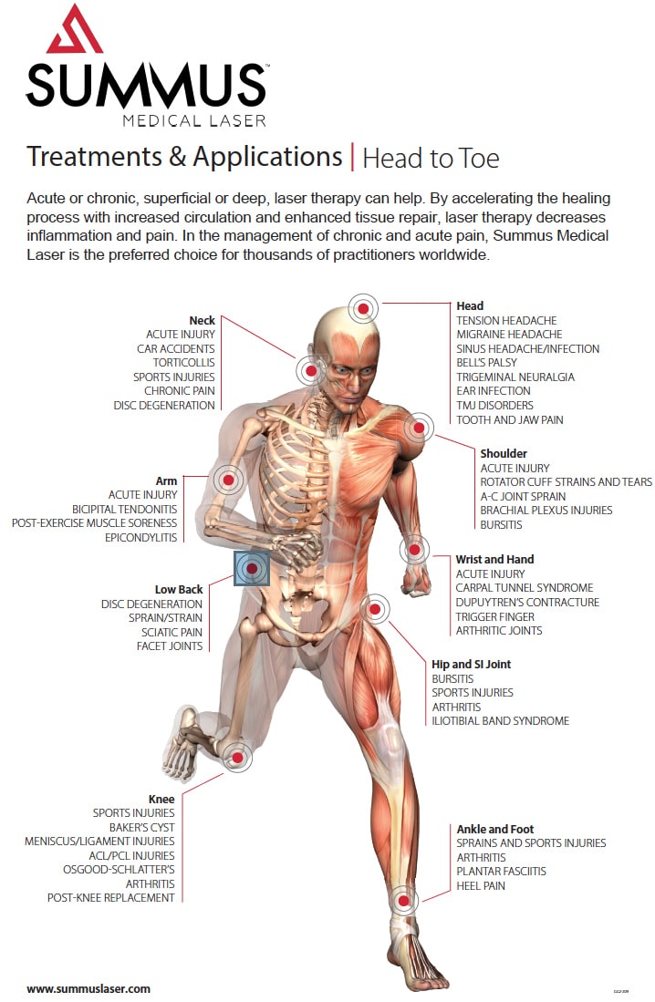 Laser Skin Tightening, InfuseLife, Medical Spa, IV Therapy